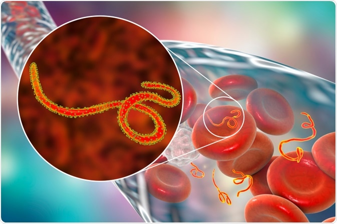 What is Ebola virus disease?   